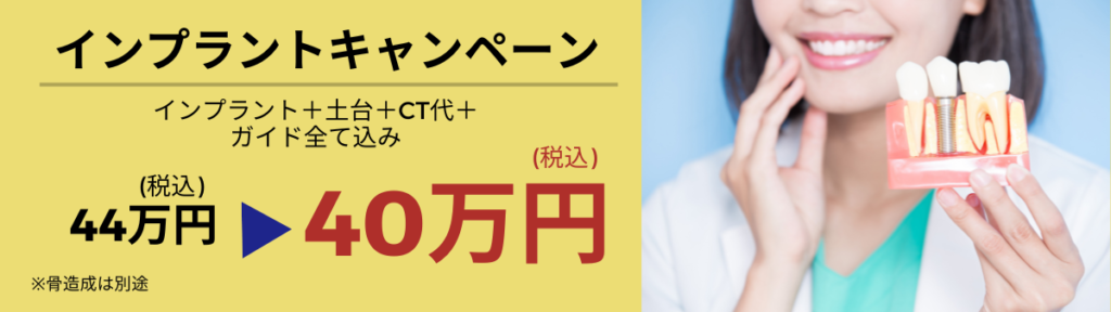 上大岡駅の歯医者「アーバン歯科・上大岡駅前院」はインプラントのキャンペーンを実施中です