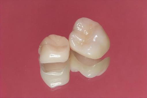 セラミック 種類 特徴